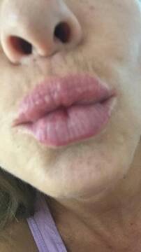 Kiss