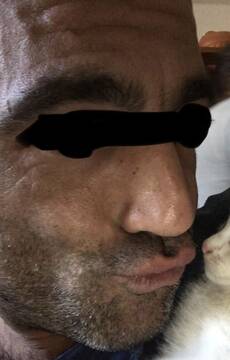 bacio