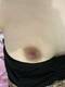 My nipple