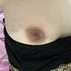 My nipple