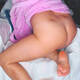 Fossette di Venere piedi